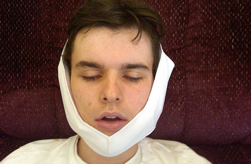 wisdom teeth emergency